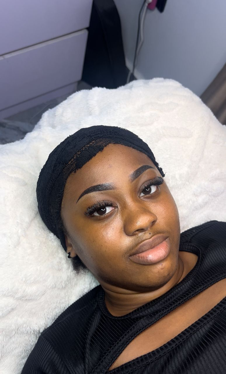 Brow Transformation After