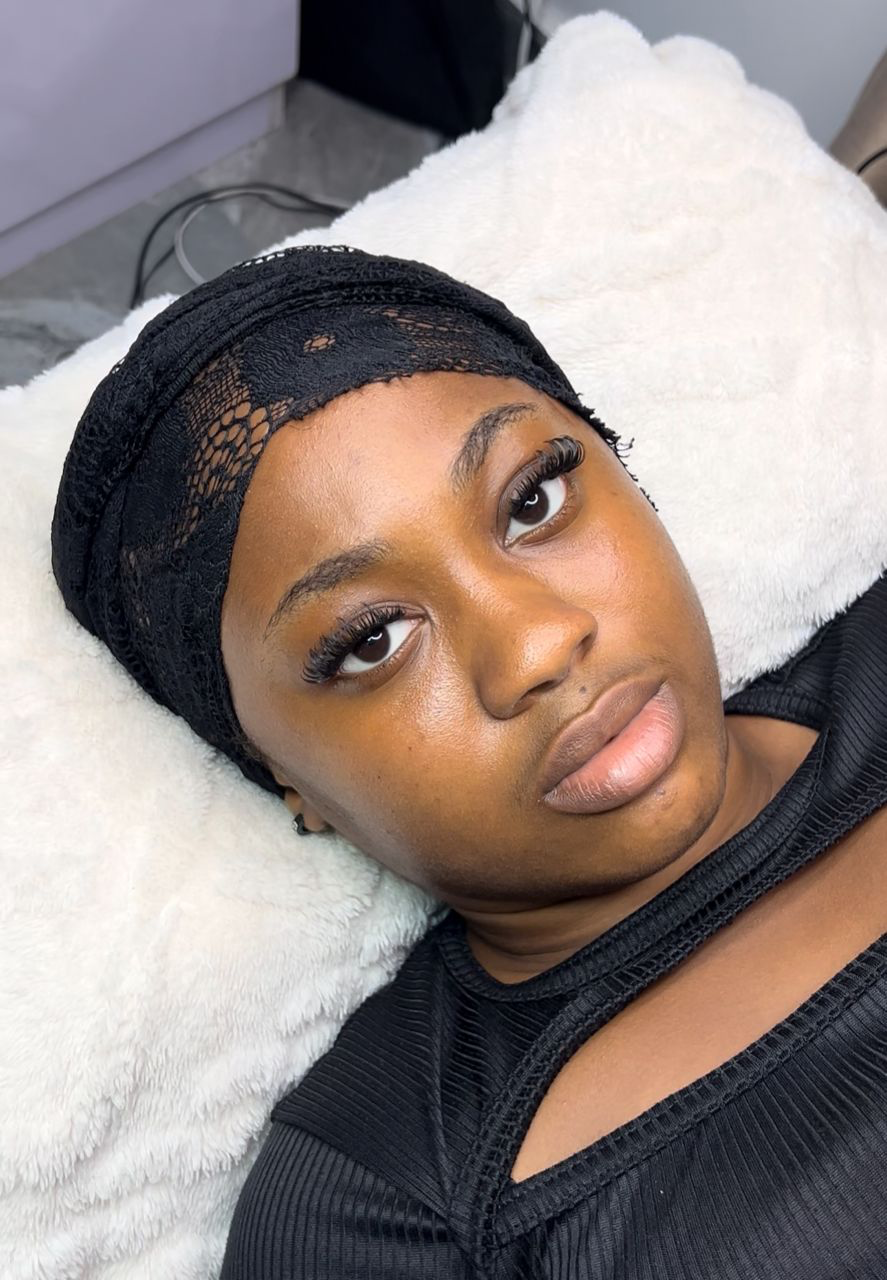 Brow Transformation Before